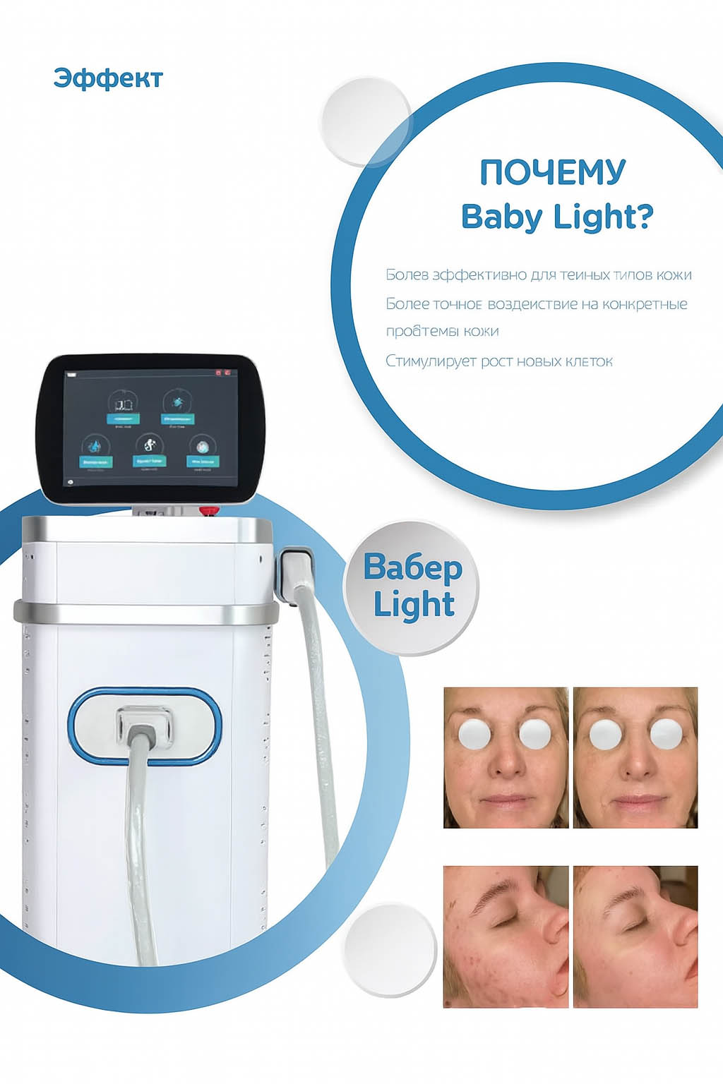 Преимущества Baby Light технологии